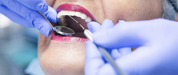 Best Emergency Dental Care for Abscessed Tooth in Gaffney, SC